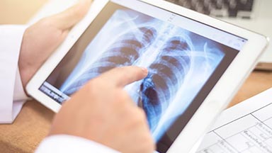 Lung Cancer Detection project